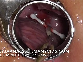 Unskilful FreyjaAnalslut : Bumping off the brush IUD - pulling it glory in Freyja's Cervix, synod the brush fecund evermore - Lively synopsis atop ManyVids